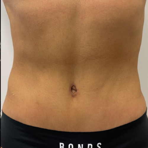 ab 2